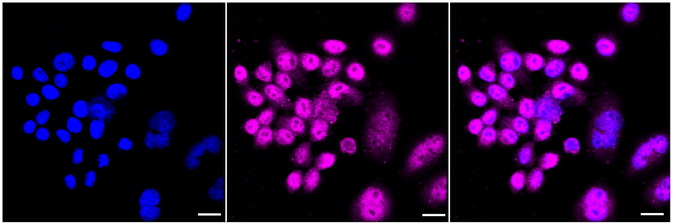 KGF/FGF-7 Antibody (23GB3840)