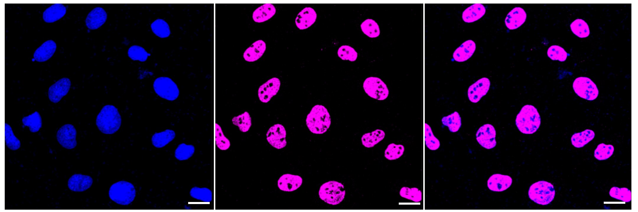 CYP24A1 Antibody (23GB3795)
