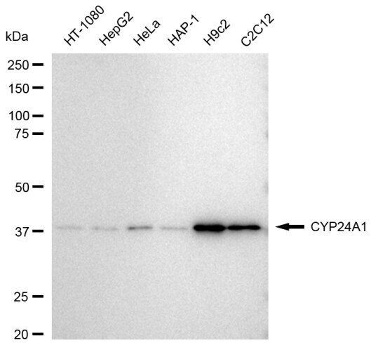 CYP24A1 Antibody (23GB3795)