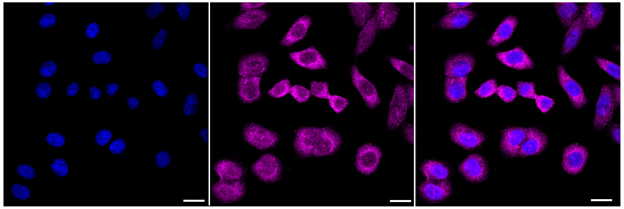 AG-2/AGR2 Antibody (23GB1840)