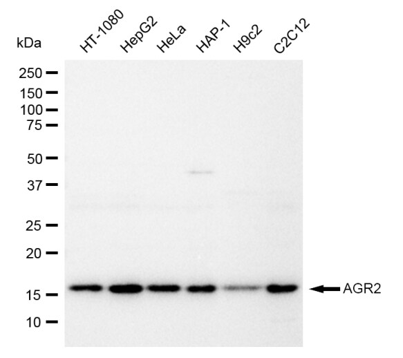 AG-2/AGR2 Antibody (23GB1840)