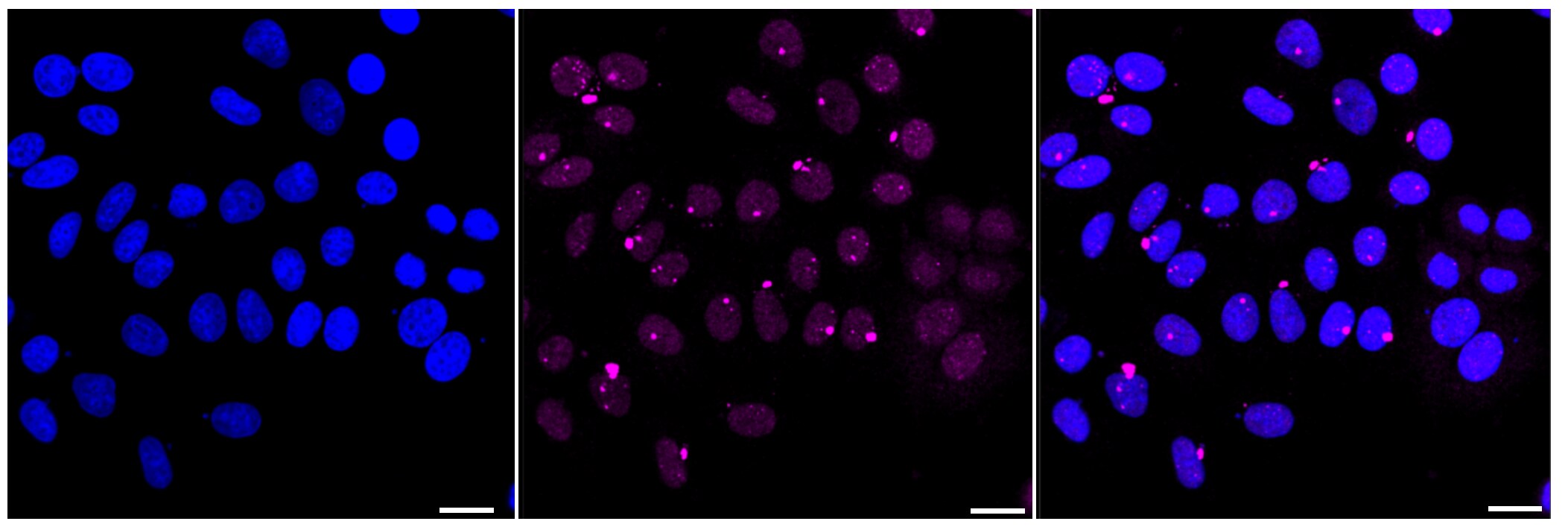 RSK2 Antibody (23GB1530)