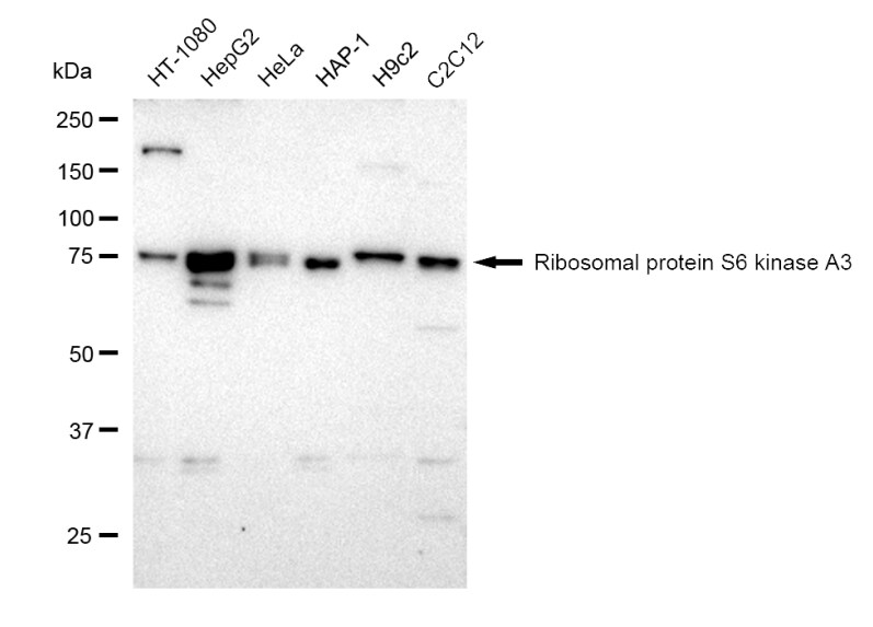 RSK2 Antibody (23GB1530)