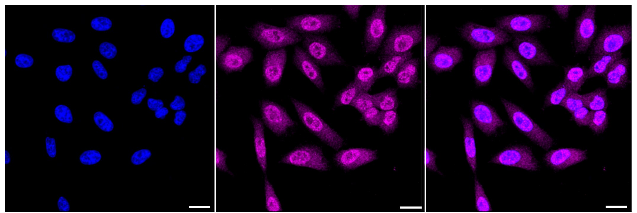 Coilin Antibody (23GB1575)