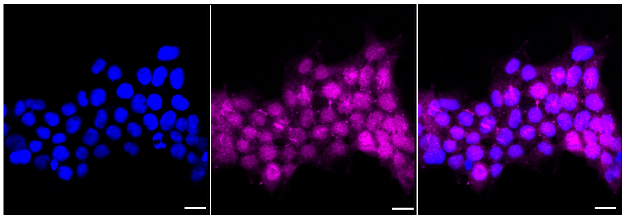 ATF5 Antibody (23GB3145)