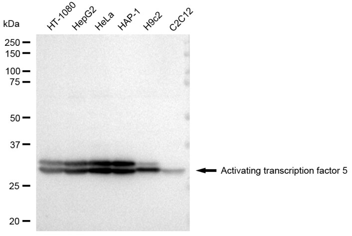 ATF5 Antibody (23GB3145)