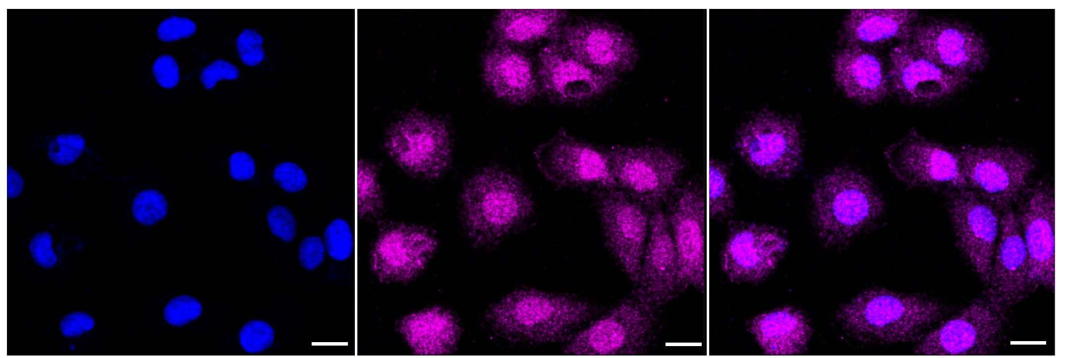 UBE2R1/CDC34 Antibody (23GB3435)