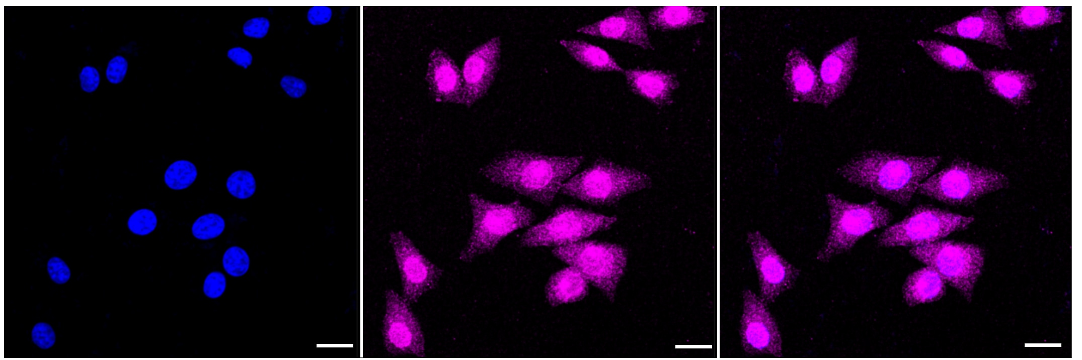 DAP Kinase 1 Antibody (23GB3565)