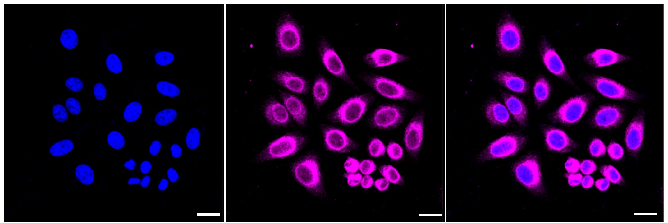 ELOVL5 Antibody (23GB3580)