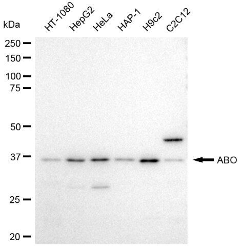 Blood Group B Transferase/GTB/ABO Antibody (23GB3610)