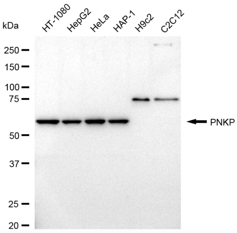 PNK Antibody (24GB965)