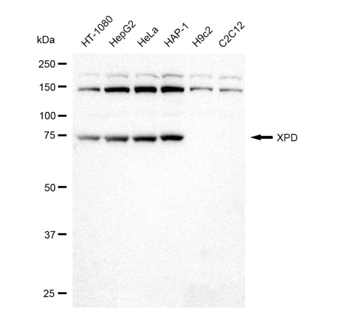 XPD Antibody (23GB1675)
