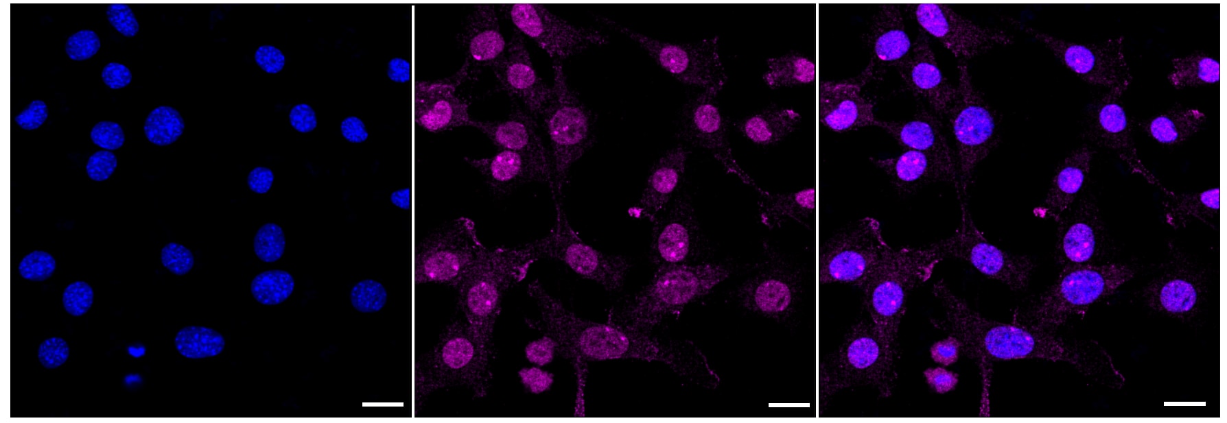 Apolipoprotein F Antibody (23GB3670)