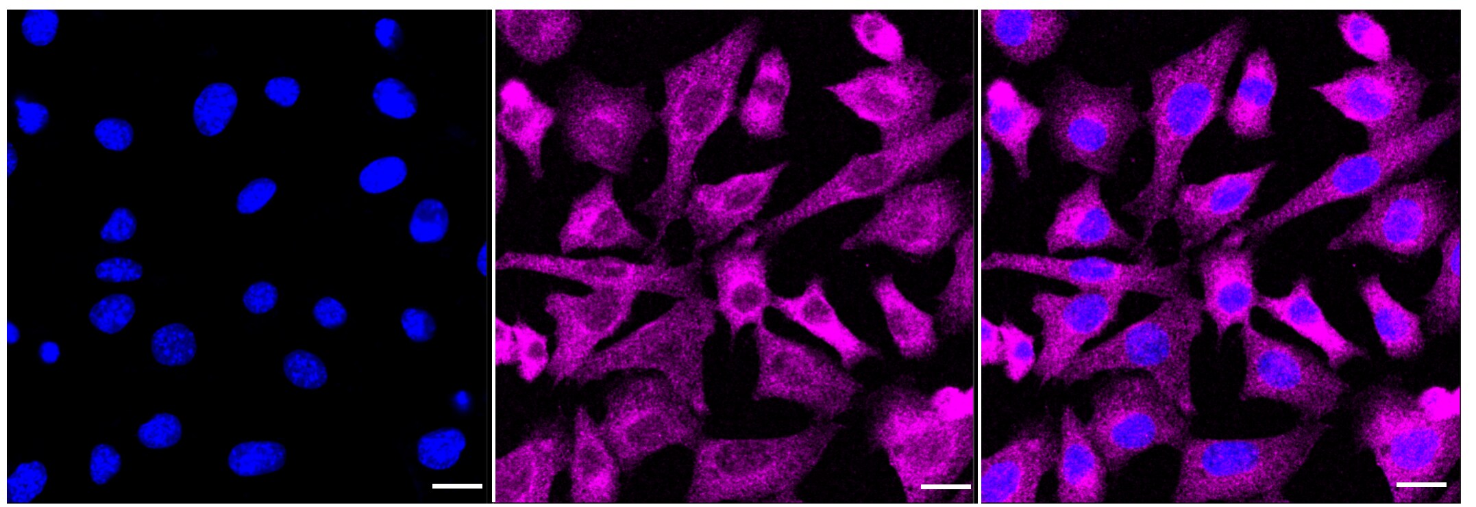 Acetyl-CoA Carboxylase alpha/ACACA [p Ser79] Antibody (23GB3865)