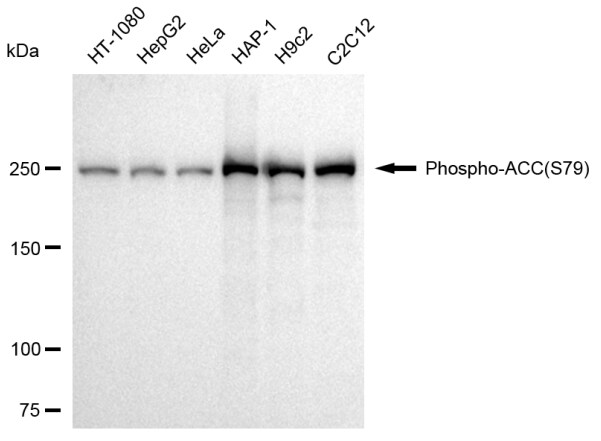 Acetyl-CoA Carboxylase alpha/ACACA [p Ser79] Antibody (23GB3865)