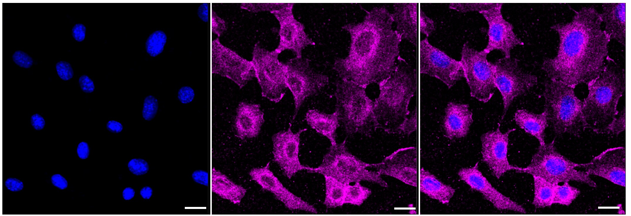 p120-catenin [p Tyr228] Antibody (23GB3880)