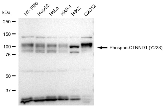 p120-catenin [p Tyr228] Antibody (23GB3880)