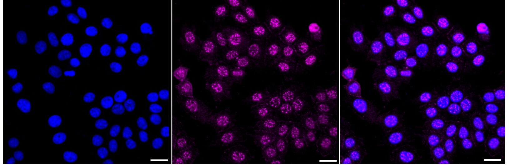 EGFR [p Tyr1092] Antibody (23GB3890)