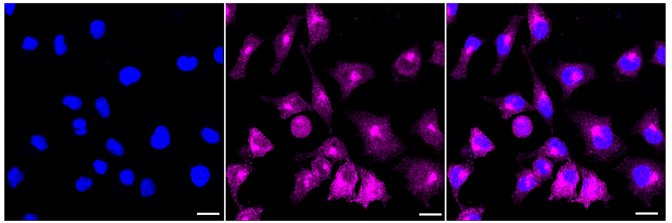 ADAMTS13 Antibody (23GB3925)