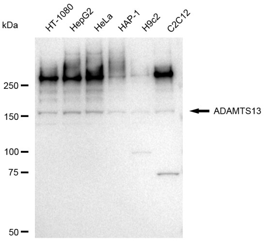 ADAMTS13 Antibody (23GB3925)