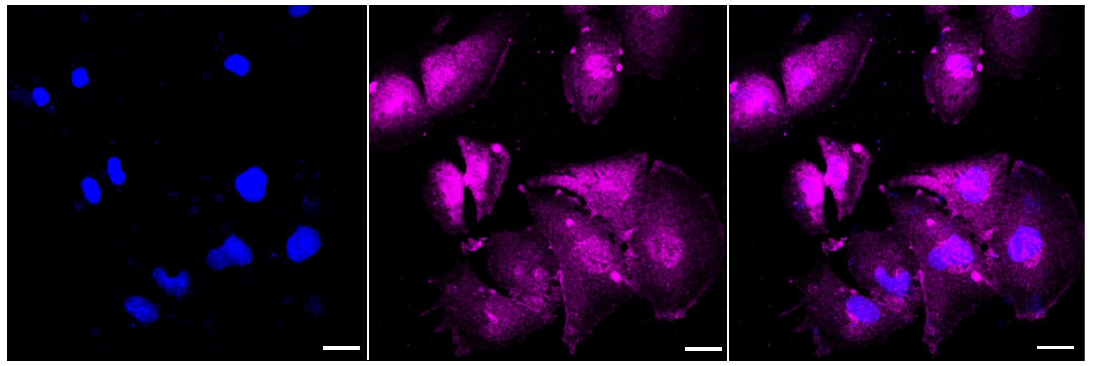 AKAP14 Antibody (23GB3935)