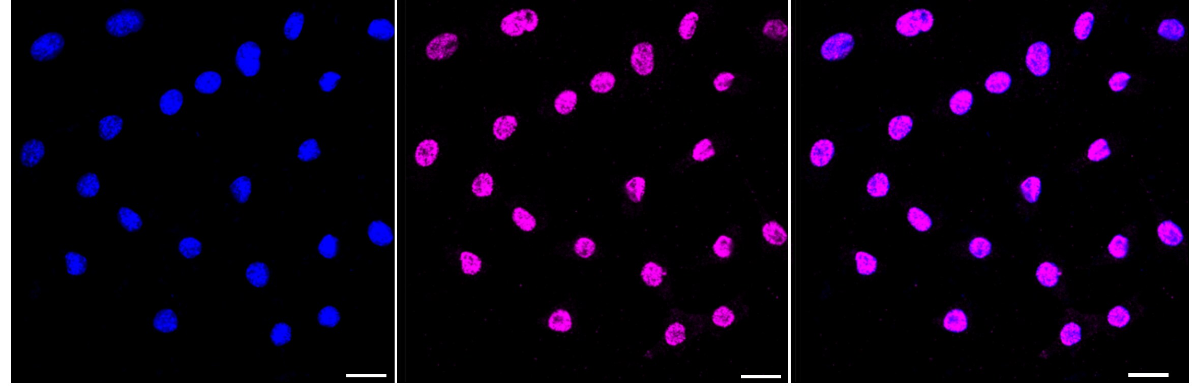 Histone H3 [Sym-dimethyl Arg17] Antibody (23GB3965)