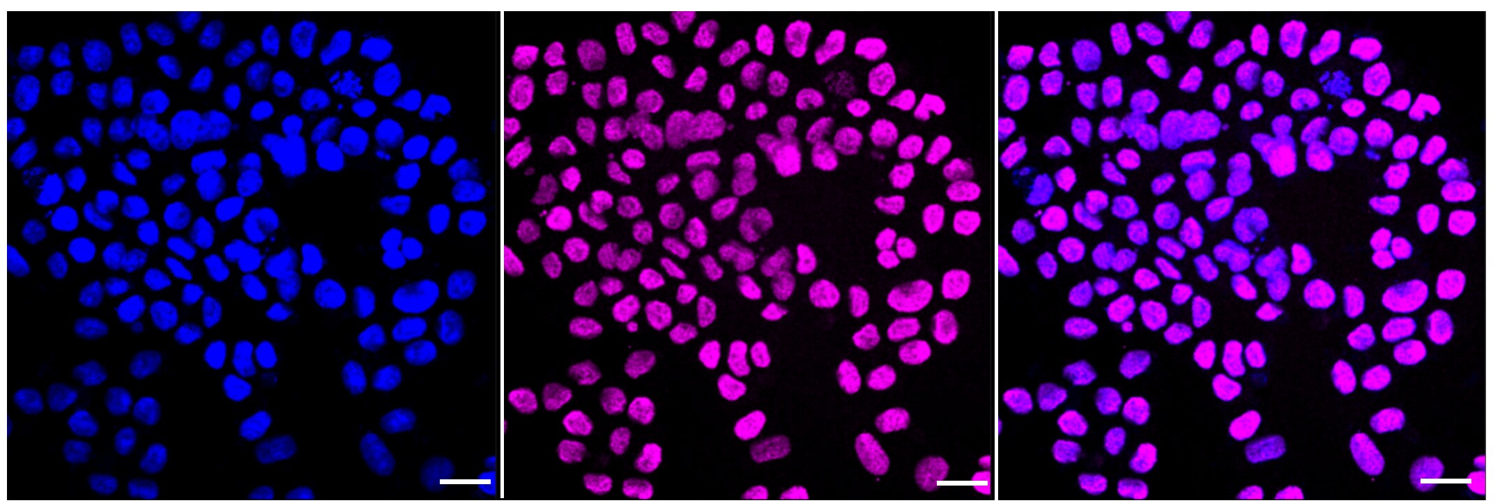 Histone H3 [ac Lys4] Antibody (23GB3980)