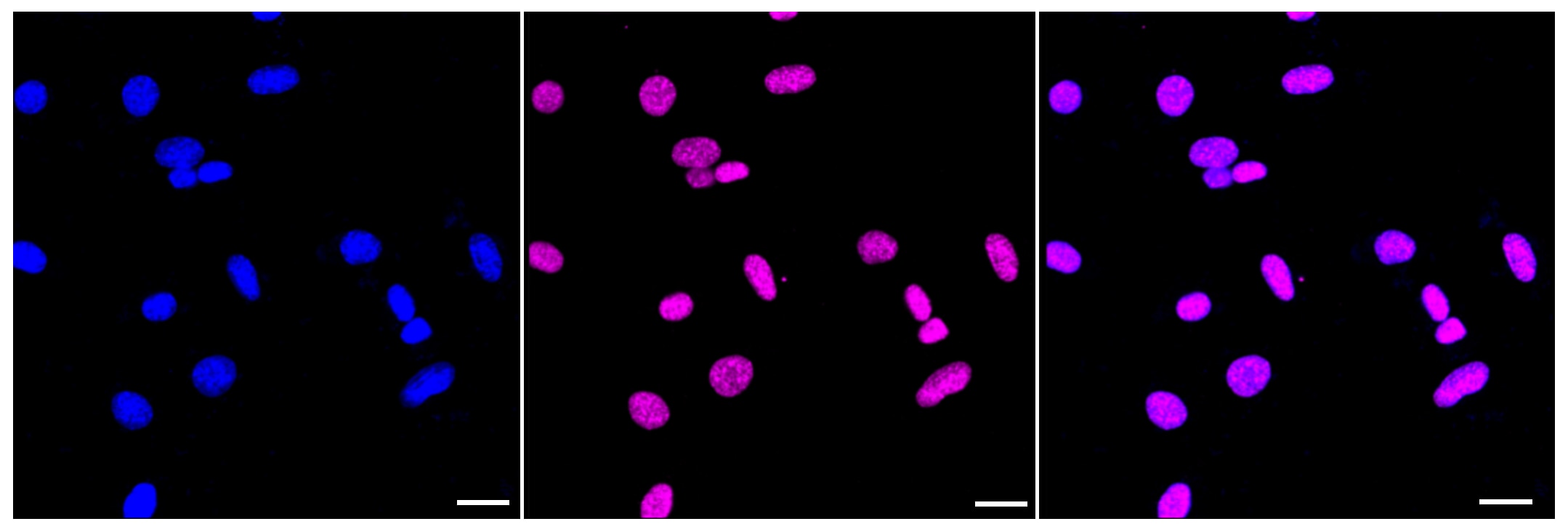 Histone H3 [Monomethyl Lys18] Antibody (23GB3985)