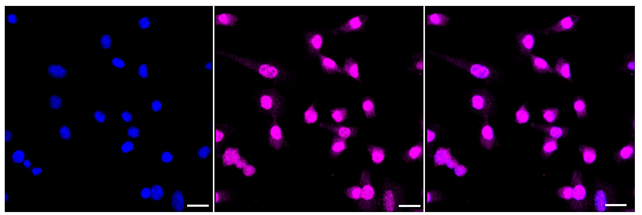MEKK4 Antibody (23GB4045)