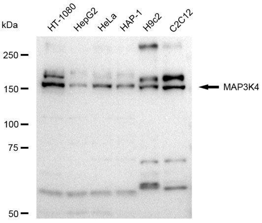 MEKK4 Antibody (23GB4045)