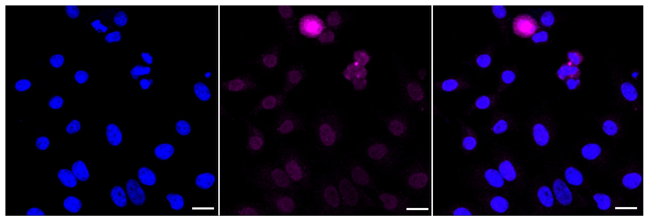 PLK1 [p Thr210] Antibody (23GB4090)