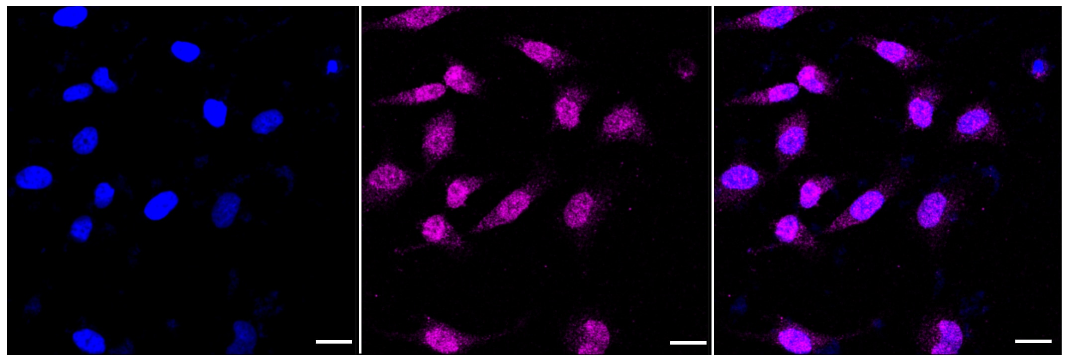 AMPK alpha 2 [p Ser345] Antibody (23GB4095)