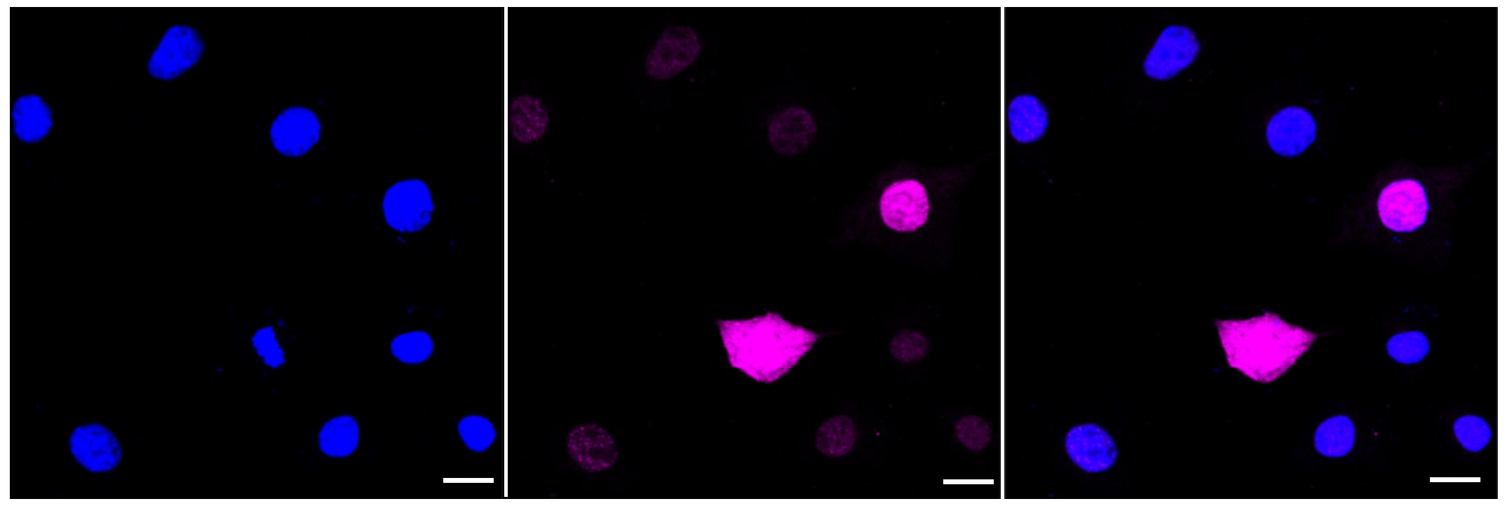 RSK1 [p Thr573] Antibody (23GB4130)