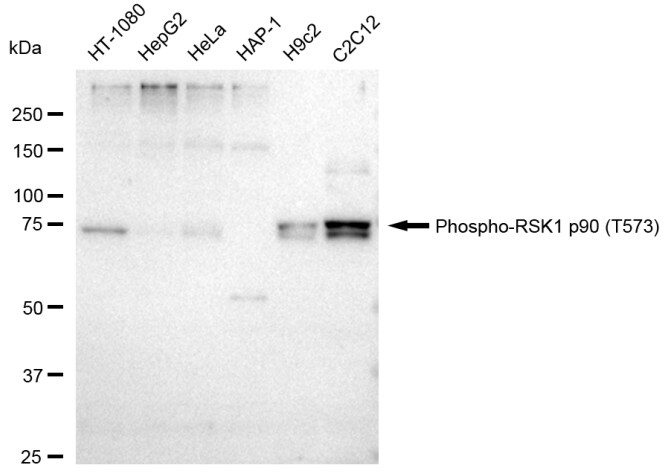 RSK1 [p Thr573] Antibody (23GB4130)