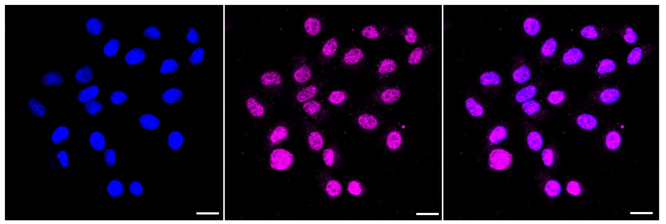 SCIN Antibody (23GB4135)