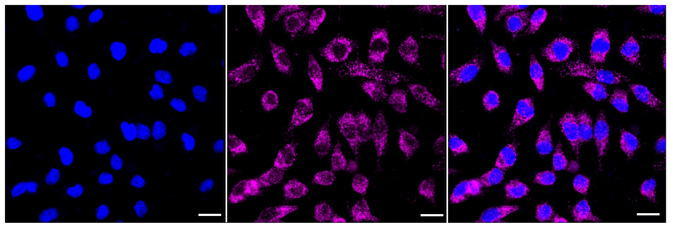 GlyT2/SLC6A5 Antibody (23GB4145)