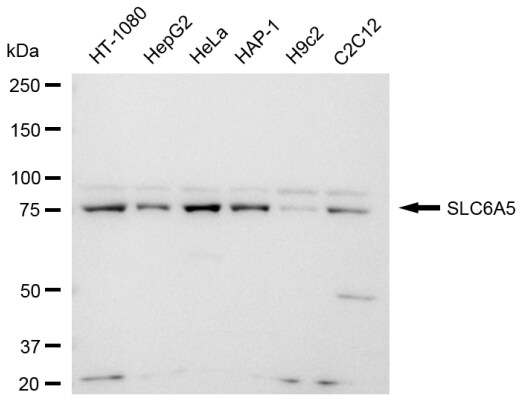 GlyT2/SLC6A5 Antibody (23GB4145)
