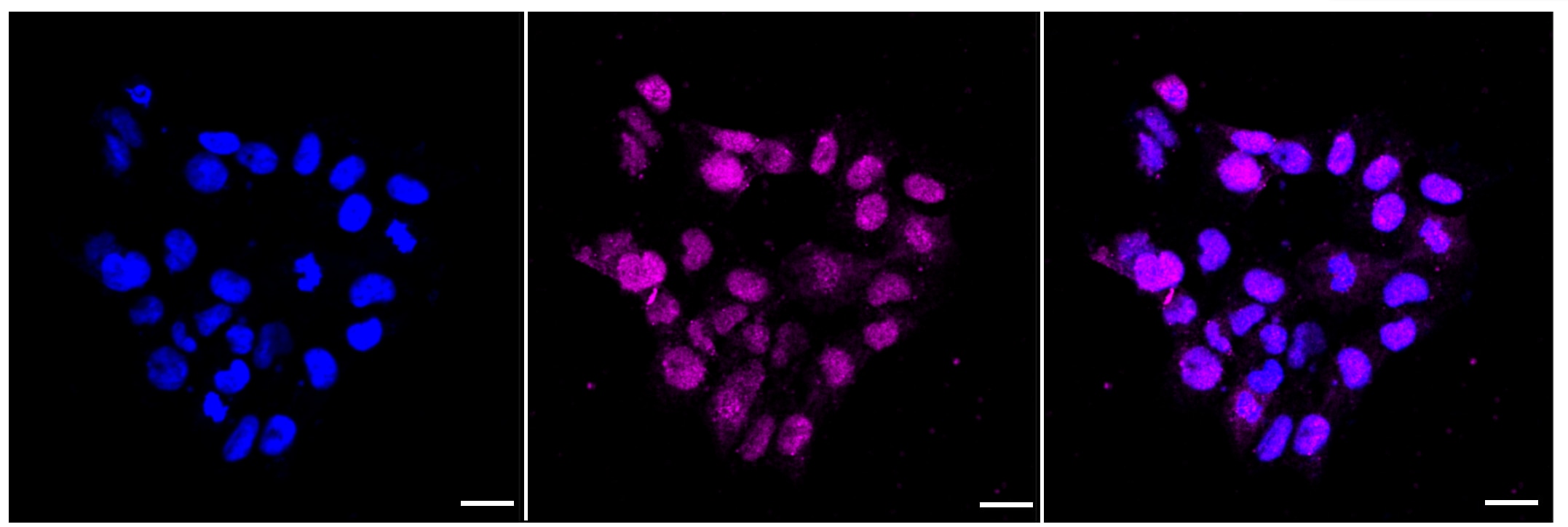 SMAD1/5/9 [p Ser467] Antibody (23GB4155)