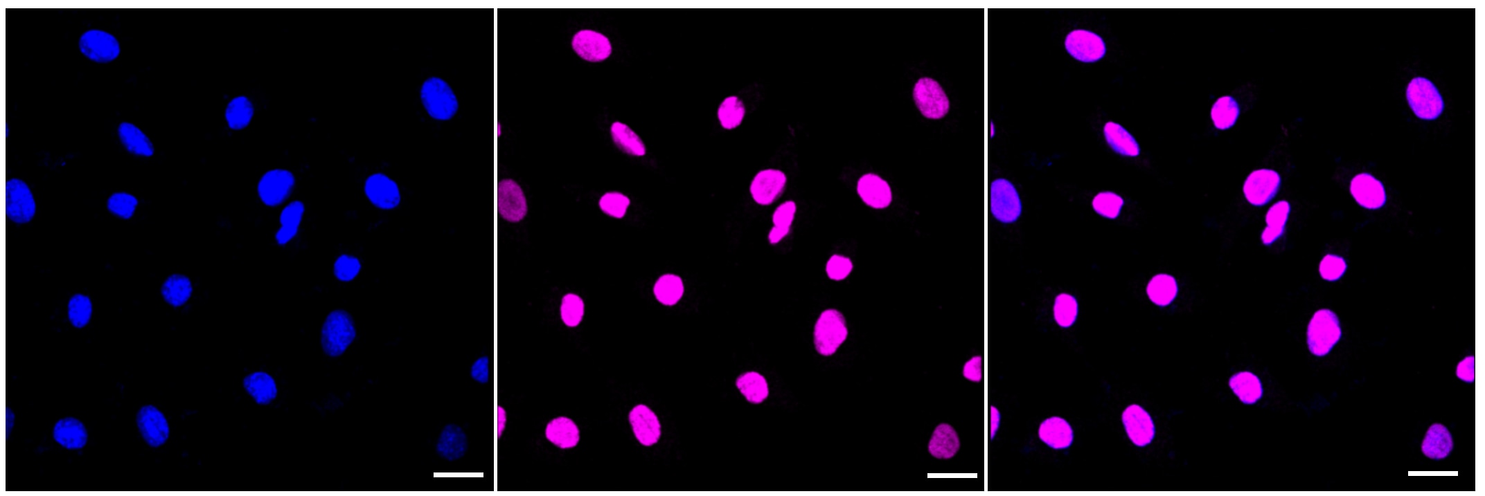 SMARCA5/SNF2H Antibody (23GB4160)