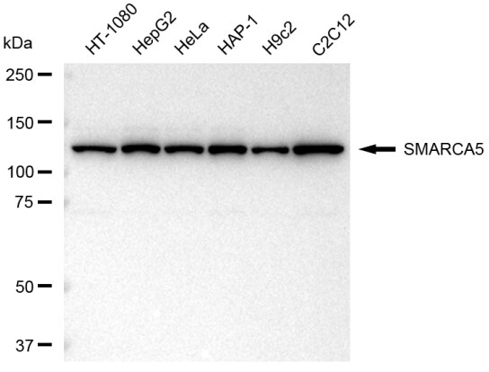 SMARCA5/SNF2H Antibody (23GB4160)