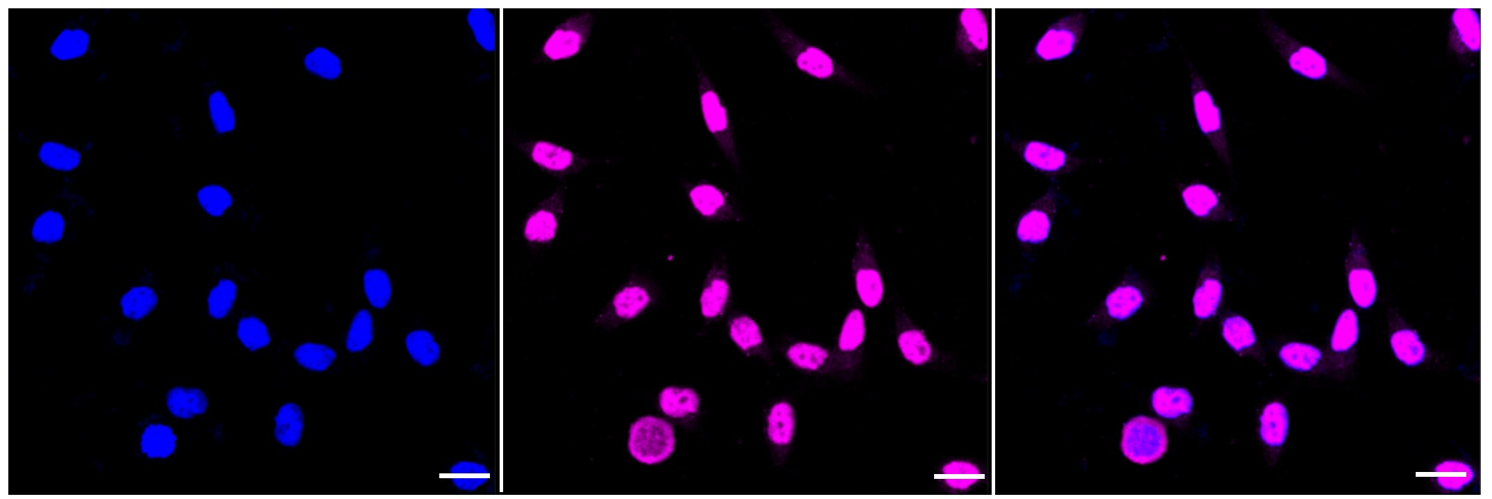 SP1 Antibody (23GB4175)
