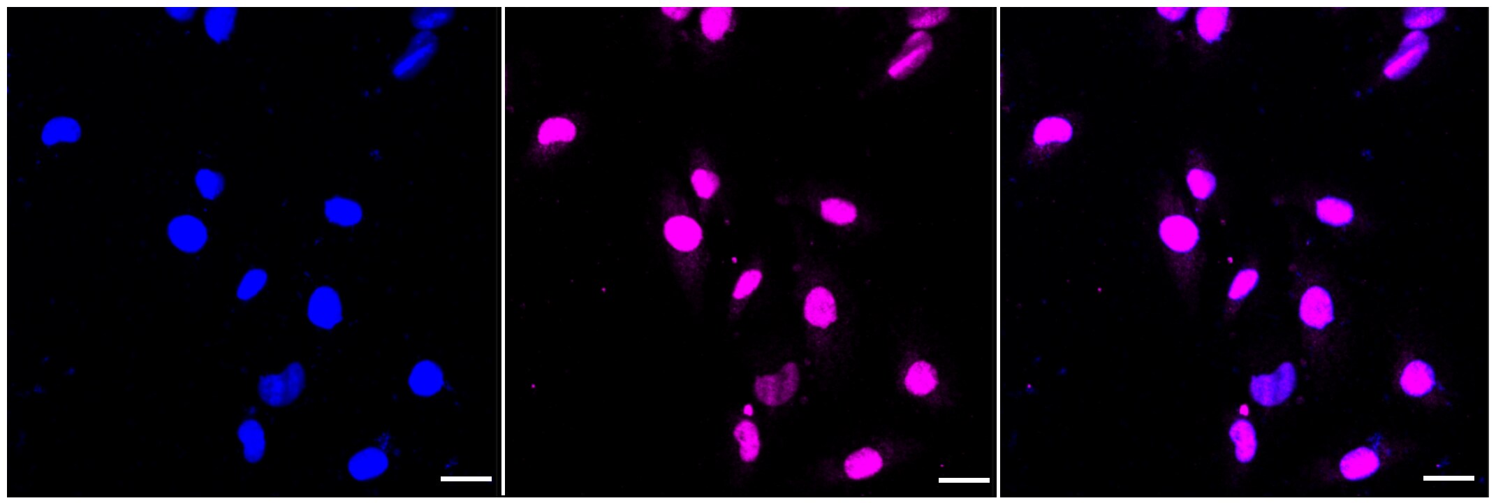 STAT1 [p Tyr701] Antibody (23GB4200)