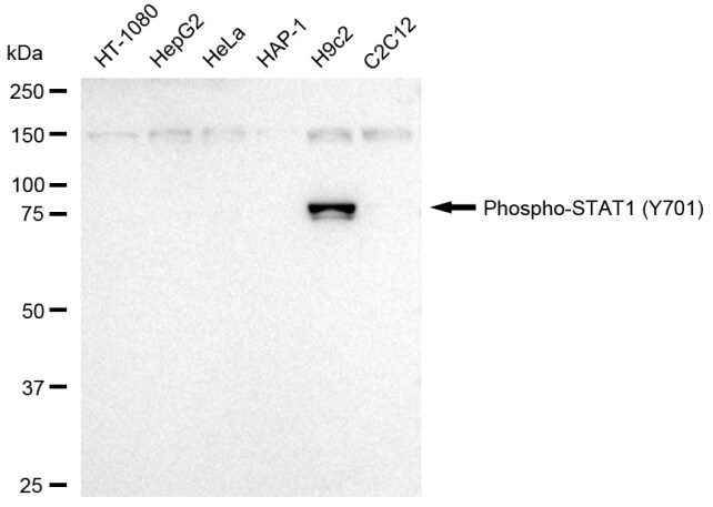 STAT1 [p Tyr701] Antibody (23GB4200)