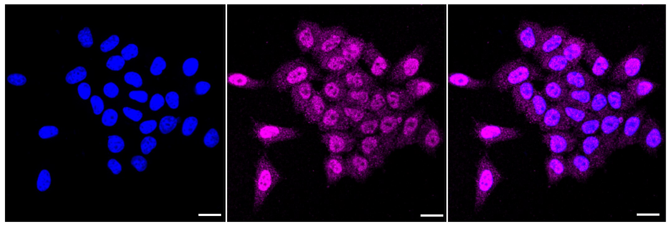 Tensin 4/CTEN Antibody (23GB4225)