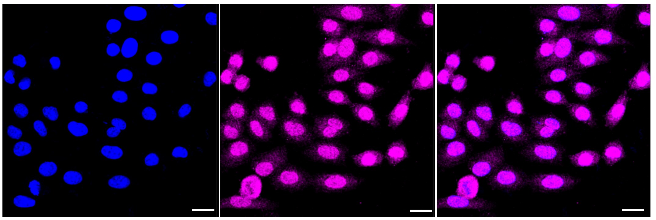 TRAPPC2 Antibody (23GB4230)