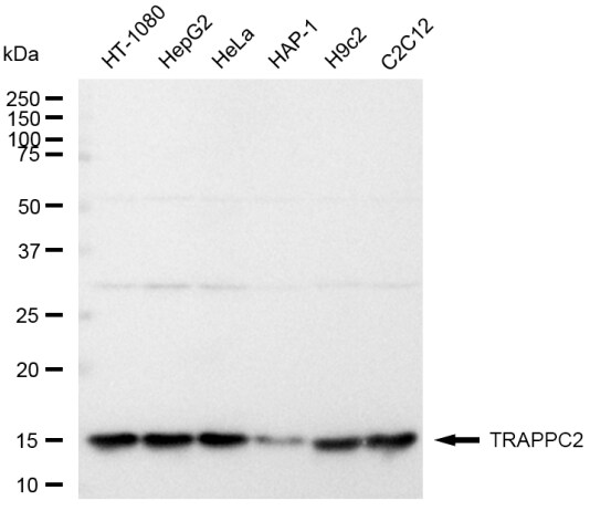 TRAPPC2 Antibody (23GB4230)