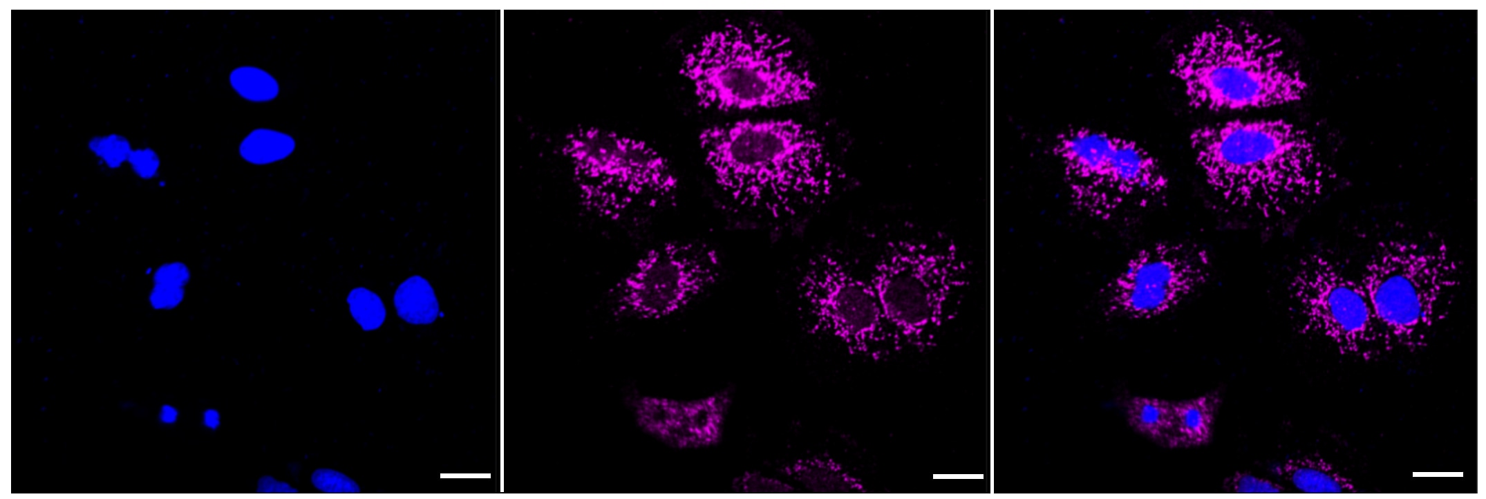 AGTR-2 Antibody (23GB4305)