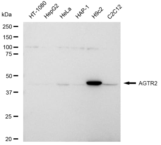 AGTR-2 Antibody (23GB4305)