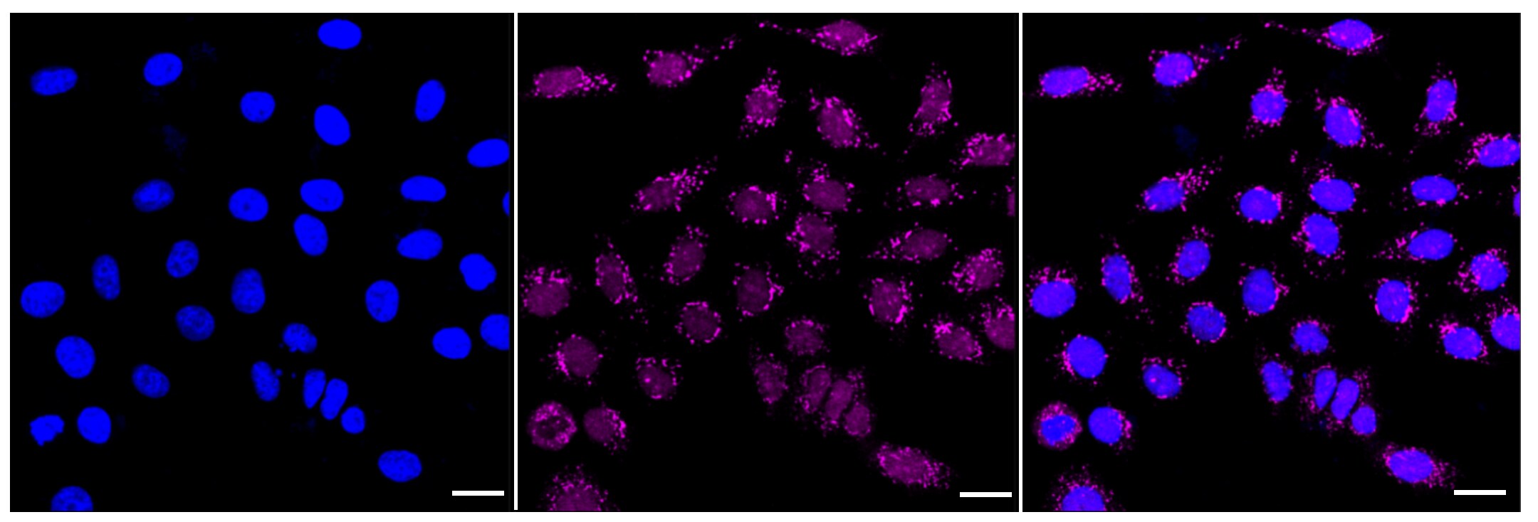 ATF1 Antibody (23GB4325)