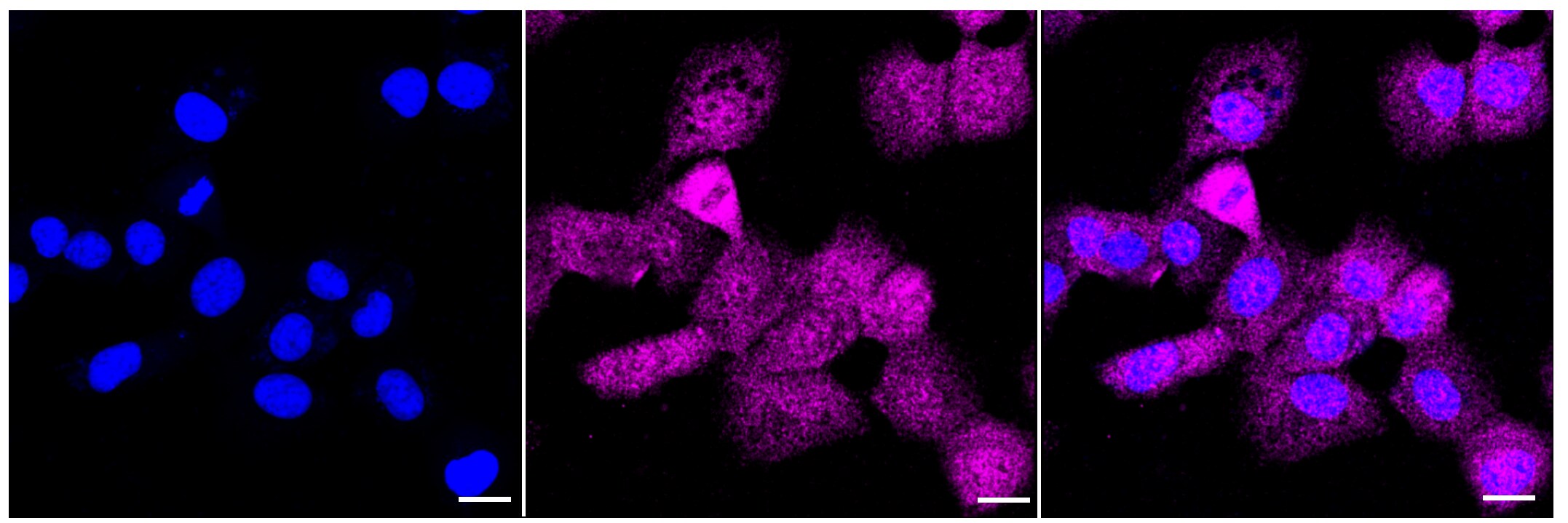 CABP1 Antibody (23GB4365)